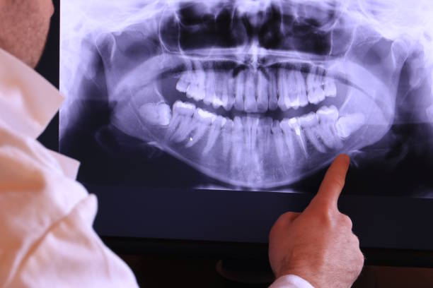 Best Emergency Dentist for Knocked-Out Tooth in , IA